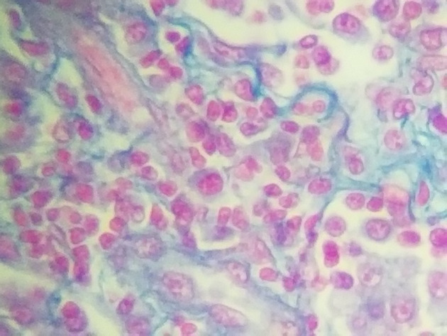 Reticular Connective Slides - Reticular Connective 07 400X